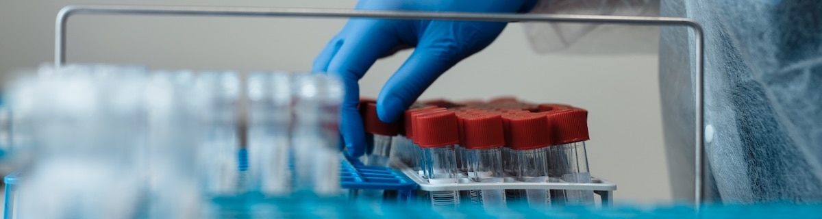 Field-to-Bench Contamination Control
