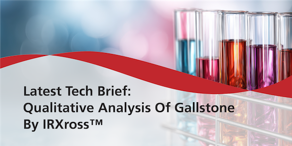 Latest Tech Brief: Qualitative Analysis of Gallstone by IRXross™ | Shimadzu