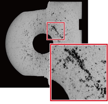 High-Resolution CT Image