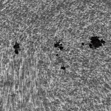 Cross Sectional Image (enlarged view)