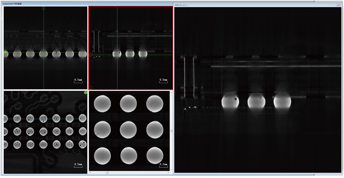 MPR Image FOV = ø5 mm