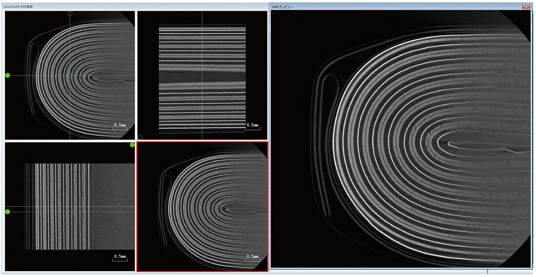 MPR Image FOV = ø 4.4 mm