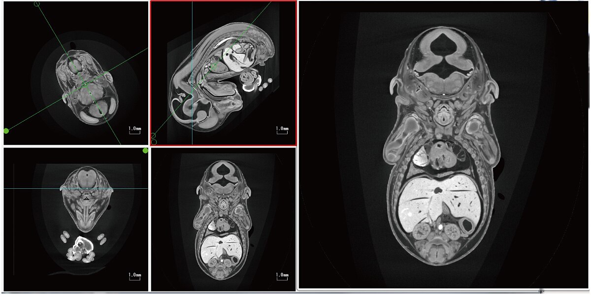 MPR Image FOV = ø 13.7 mm
