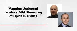 Mapping Uncharted Territory: MALDI-imaging of Lipids in Tissues